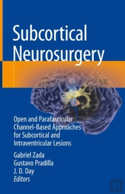 Bertrand.pt - Subcortical Neurosurgery