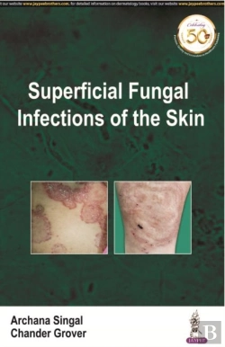 Bertrand.pt - Superficial Fungal Infections Of The Skin