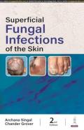 Superficial Fungal Infections Of The Skin