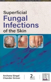 Superficial Fungal Infections Of The Skin