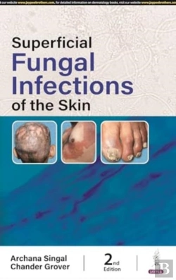 Bertrand.pt - Superficial Fungal Infections Of The Skin