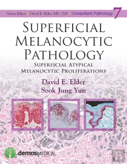 Bertrand.pt - Superficial Melanocytic Pathology