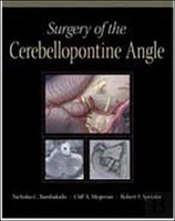 Surgery Of The Cerebellopontine Angle