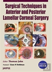 Surgery Technique In Anterior And Post. Lamellar Corneal Surgery
