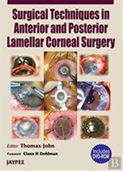 Bertrand.pt - Surgery Technique In Anterior And Post. Lamellar Corneal Surgery