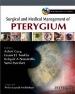 Bertrand.pt - Surgical And Medical Management Of Pterygium