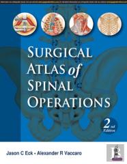 Surgical Atlas Of Spinal Operations