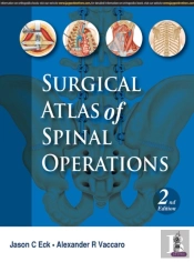 Surgical Atlas Of Spinal Operations