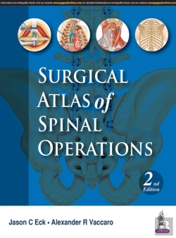 Bertrand.pt - Surgical Atlas Of Spinal Operations