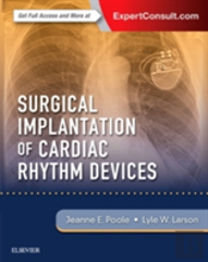 Surgical Implantation Of Cardiac Rhythm Devices