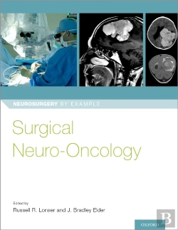 Bertrand.pt - Surgical Neuro-Oncology