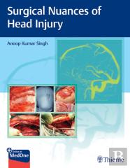 Surgical Nuances Of Head Injury
