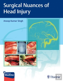 Bertrand.pt - Surgical Nuances Of Head Injury