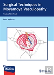 Surgical Techniques In Moyamoya Vasculopathy