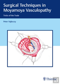 Bertrand.pt - Surgical Techniques In Moyamoya Vasculopathy