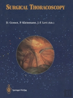 Bertrand.pt - Surgical Thoracoscopy