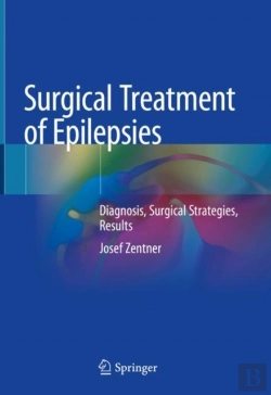 Bertrand.pt - Surgical Treatment Of Epilepsies