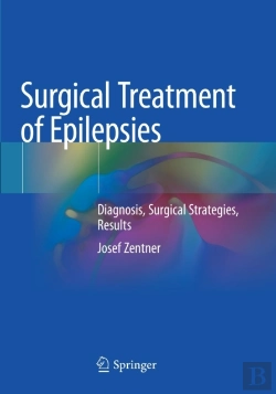 Bertrand.pt - Surgical Treatment Of Epilepsies