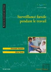 Surveillance Foetale Pendant Le Travail