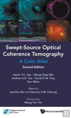 Bertrand.pt - Swept-Source Optical Coherence Tomography