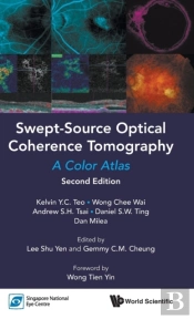 Swept-Source Optical Coherence Tomography