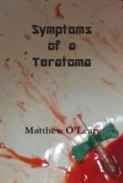 Symptoms Of A Teratoma