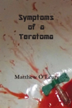 Bertrand.pt - Symptoms Of A Teratoma