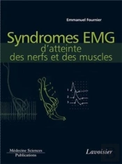 Syndromes Emg D'Atteinte Des Nerfs Et Des Muscles