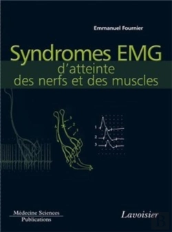 Bertrand.pt - Syndromes Emg D'Atteinte Des Nerfs Et Des Muscles