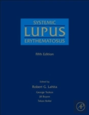 Systemic Lupus Erythematosus