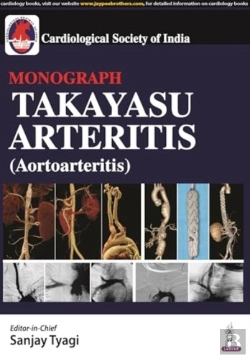 Bertrand.pt - Takayasu Arteritis (Aortoarteritis)