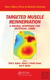 Targeted Muscle Reinnervation
