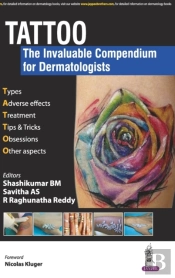 Tattoo - The Invaluable Compendium For Dermatologists