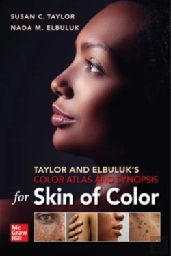 Bertrand.pt - Taylor And Elbuluk'S Color Atlas And Synopsis For Skin Of Color