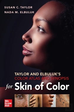 Bertrand.pt - Taylor And Elbuluk'S Color Atlas And Synopsis For Skin Of Color