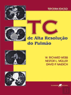 Bertrand.pt - TC de Alta Resolução do Pulmão