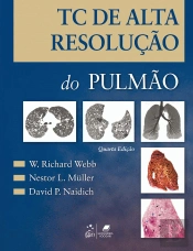 TC de Alta Resolução do Pulmão