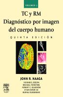 Tc Y Rm. Diagnóstico Por Imagen Del Cuerpo Humano