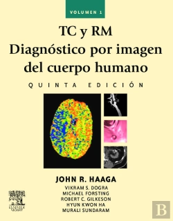 Bertrand.pt - Tc Y Rm. Diagnóstico Por Imagen Del Cuerpo Humano