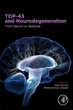 Bertrand.pt - Tdp-43 And Neurodegeneration