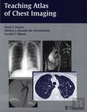 Teaching Atlas Of Chest Imaging