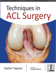 Techniques In Acl Surgery