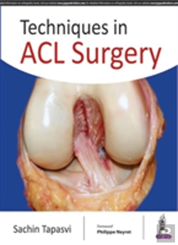 Bertrand.pt - Techniques In Acl Surgery