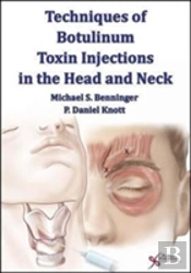 Techniques Of Botulinum Toxin Injections In The Head And Neck