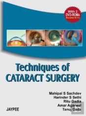 Techniques Of Cataract Surgery