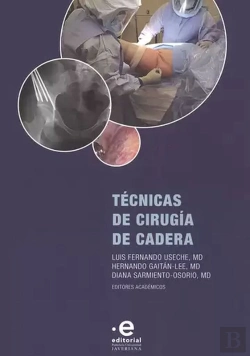 Bertrand.pt - Técnicas De Cirugía De Cadera