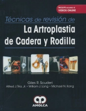 Tecnicas Revision Artroplastia Cadera Rodilla Videos Online