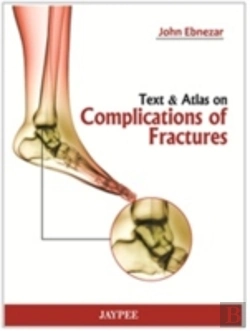 Bertrand.pt - Text And Atlas Of Complications Of Fractures