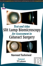 Text And Atlas: Slit Lamp Biomicroscopy For Assessment In Cataract Surgery