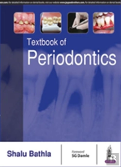 Bertrand.pt - Textbook Of Periodontics